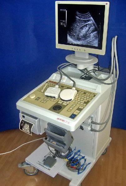 Аппарат УЗД для ультразвукового исследования KRANZBUHLER sonoScope 30