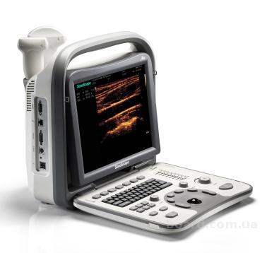 Продам портативный аппарат УЗИ Sonoscape S6BW с импульсно-волновым доплером