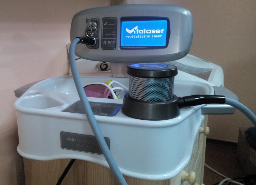 Аппарат для лазерной биоревитализации Vitalaser Германия