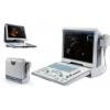 Украина Siemens ACUSON X300 Ultrasound System, premium edition